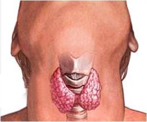 Tiroiditida štítnej žľazy, príznaky a liečba